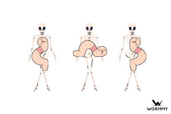 do worms eat your body when you die blog post image