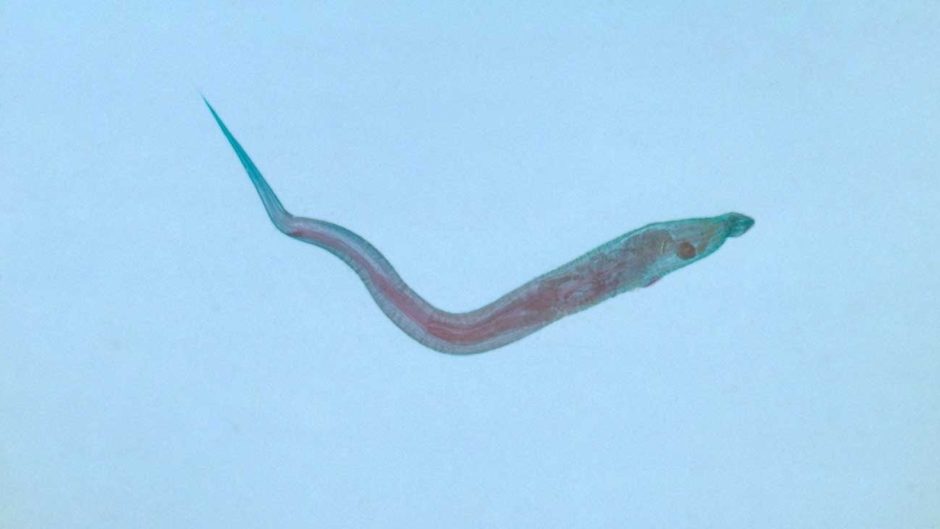 Tapeworm Vs Pinworm: What Is The Difference?