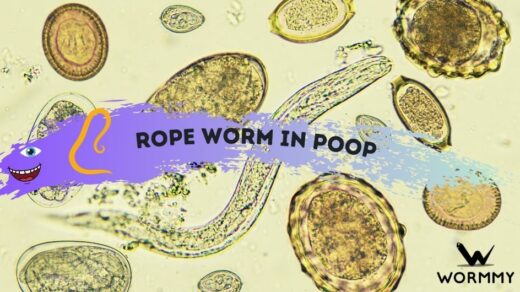 rope-worm-in-poop-mucus-or-actual-worms