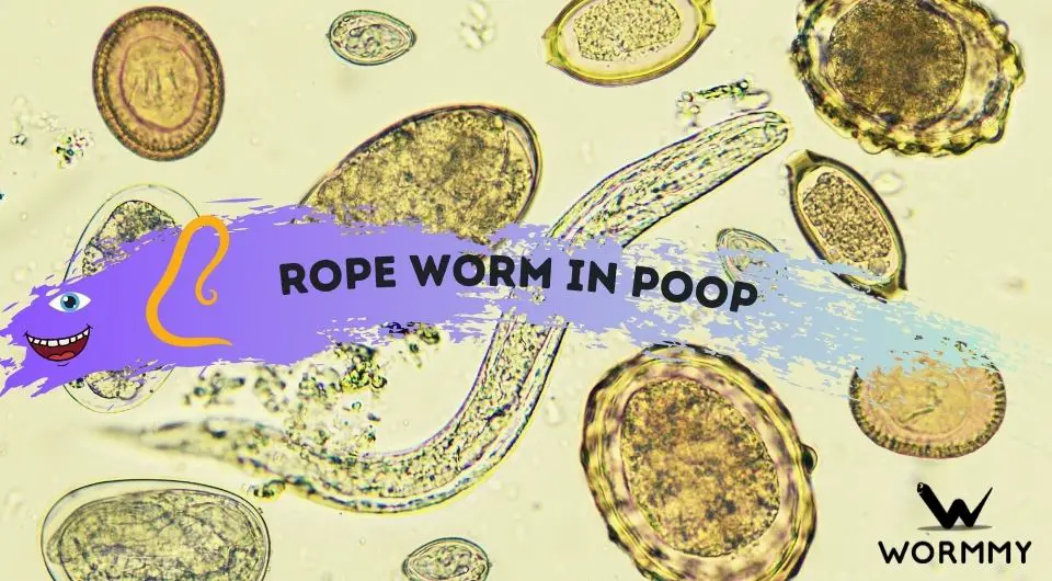Rope Worm in Poop (Mucus or Actual Worms?)