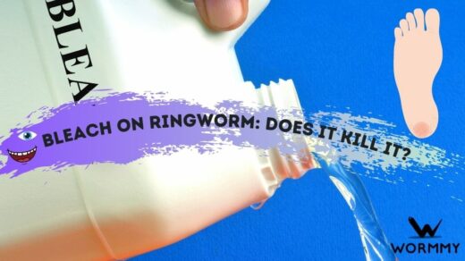 how-long-does-ringworm-last