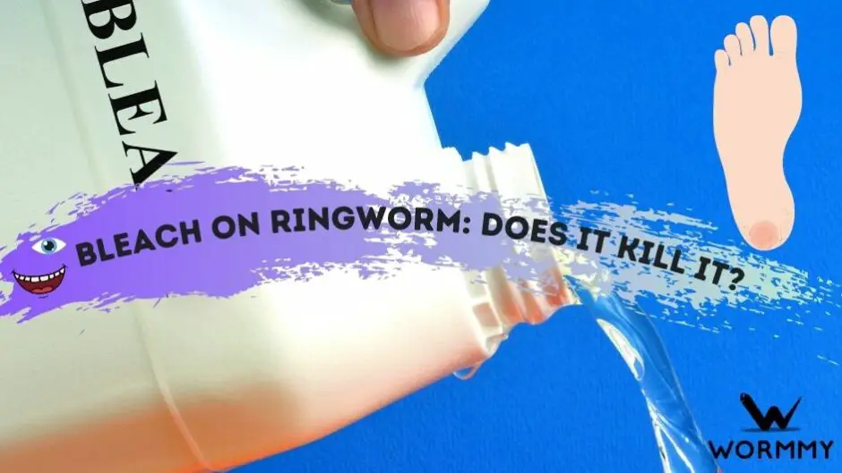 Bleach on Ringworm Does it Kill It? (On Skin & Surfaces)