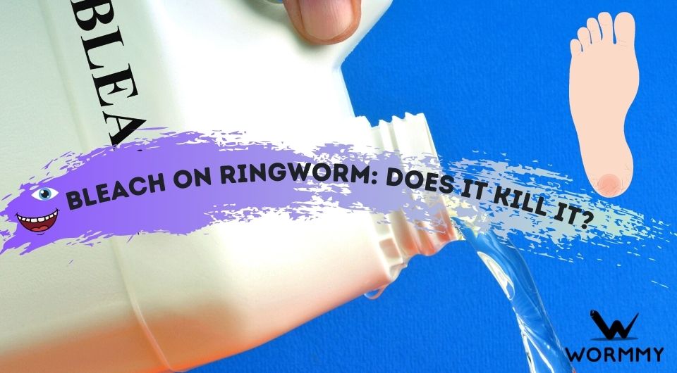 Bleach on Ringworm Does it Kill It? (On Skin & Surfaces)